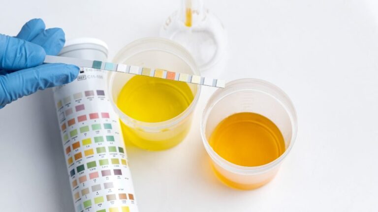 What Does Your Urine Color Say About Your Health?