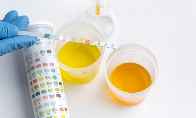 Urine Color