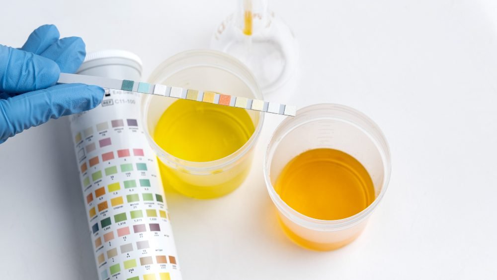 Urine Color