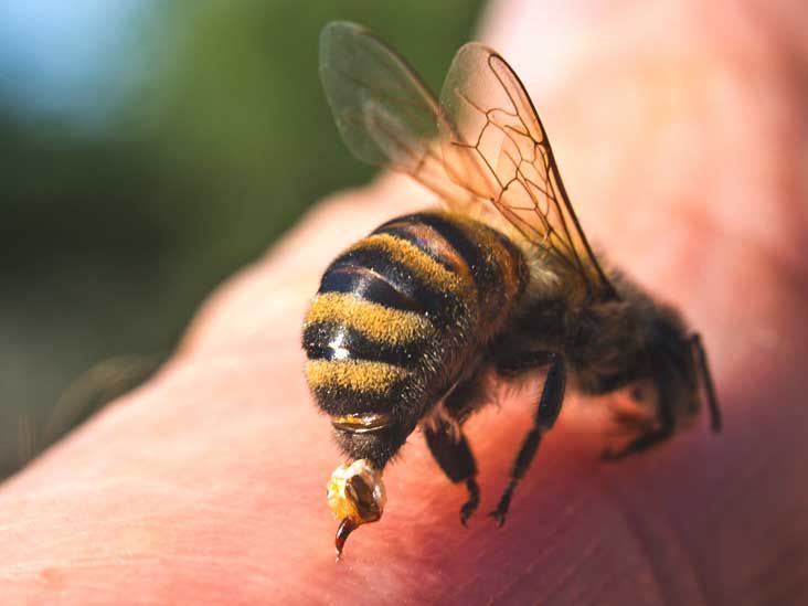 Bee Stings Are Medicinal, a Sting or 2 Is Good – Ghanaian Researcher 1 Bee stings,Medicinal