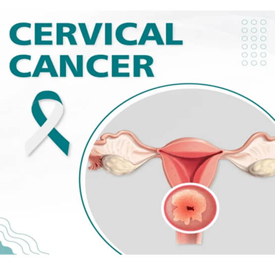Cervical Cancer: Know the Risks, Spot the Signs, and Take Control