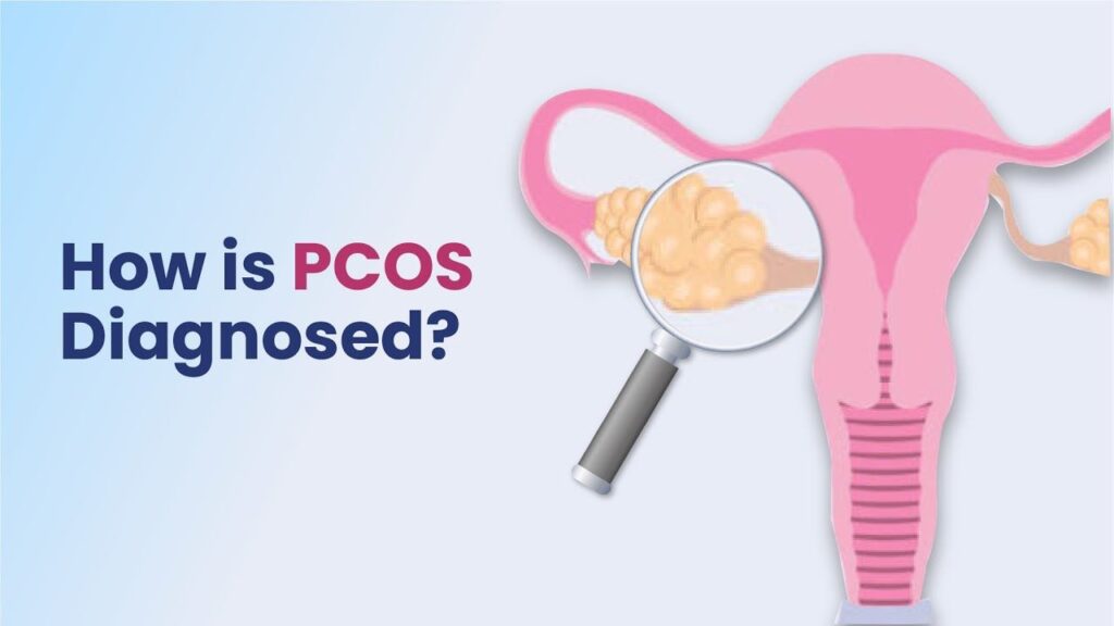 PCOS